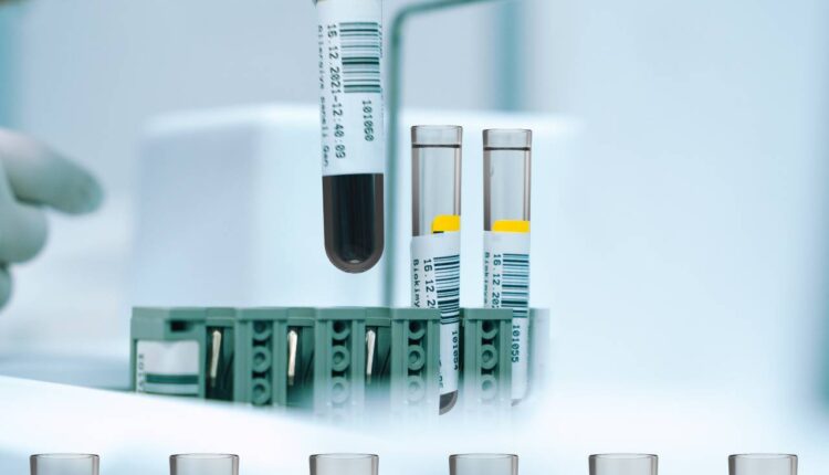 Time- and Cost-Saving Core-Centering Feature is Ideal for Blood Collection Tube Production.